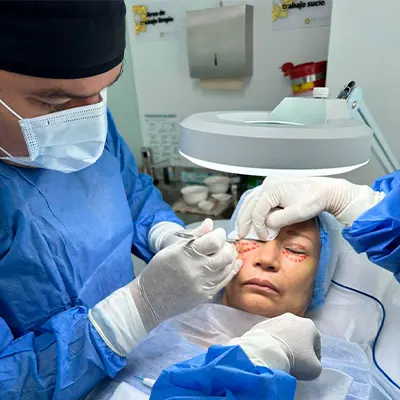 img-blefaroplastia-en-medellin-1-LCP