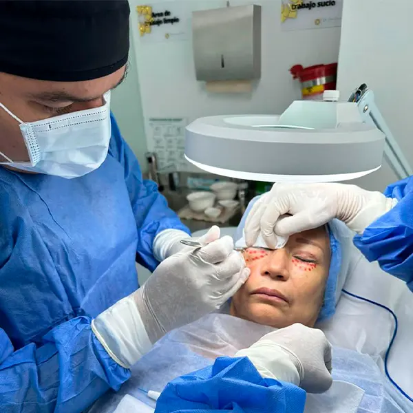 img-blefaroplastia-en-medellin-1