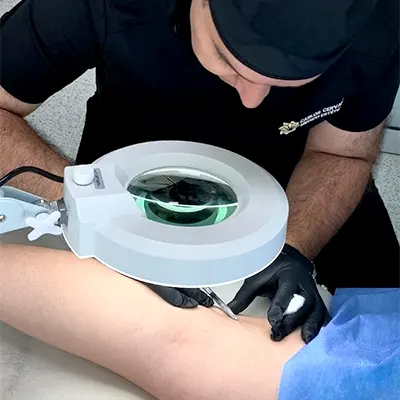 img-escleroterapia-en-medellin-1-LCP