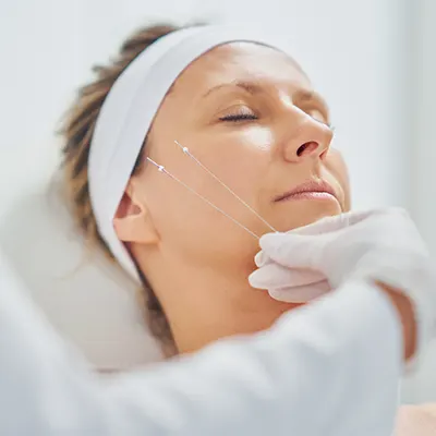 img-hilos-de-colageno-en-medellin-1-LCP