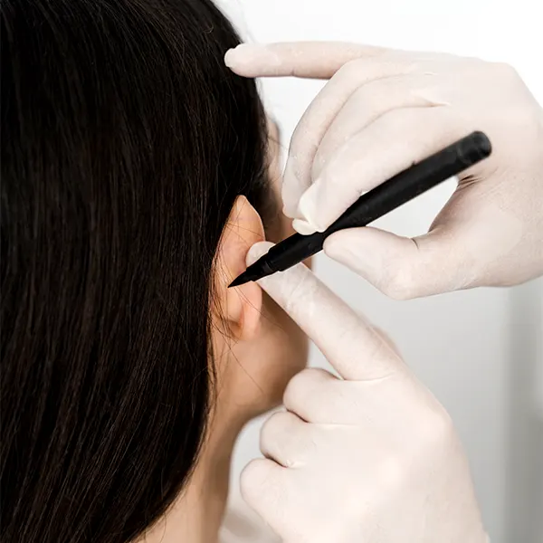 img-otoplastia-en-medellin-1