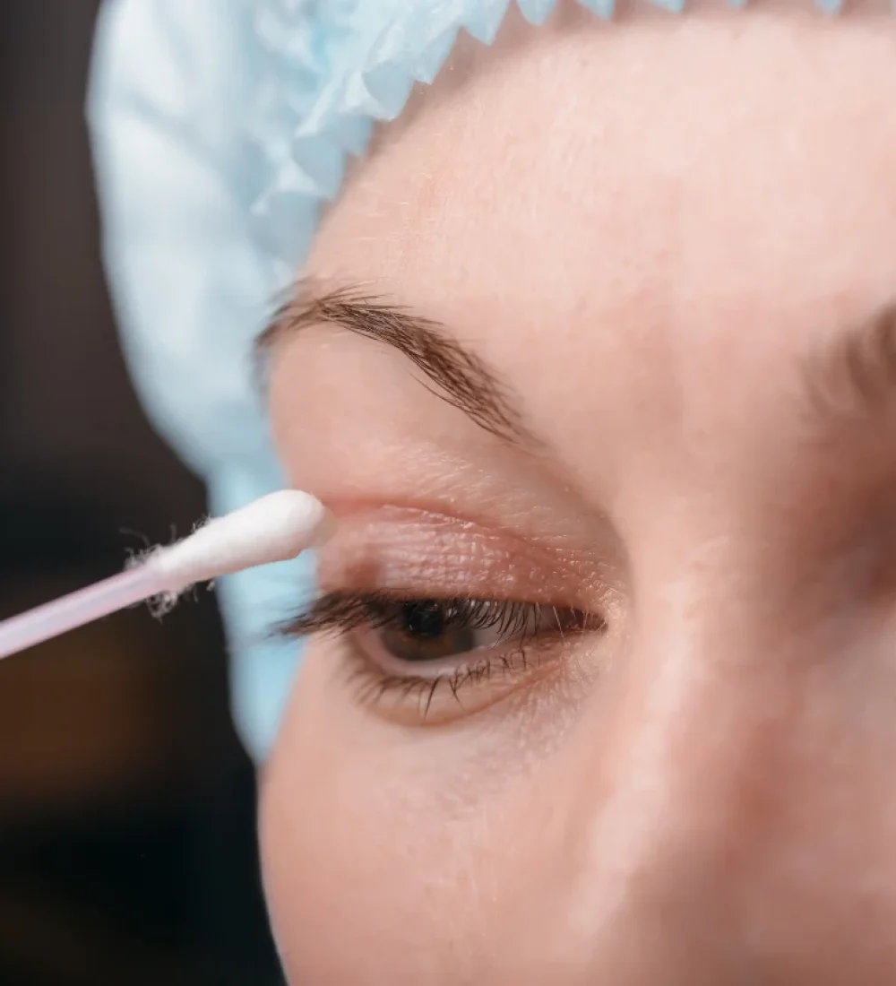 blefaroplastia--por-el-dr-carlos-cervantes