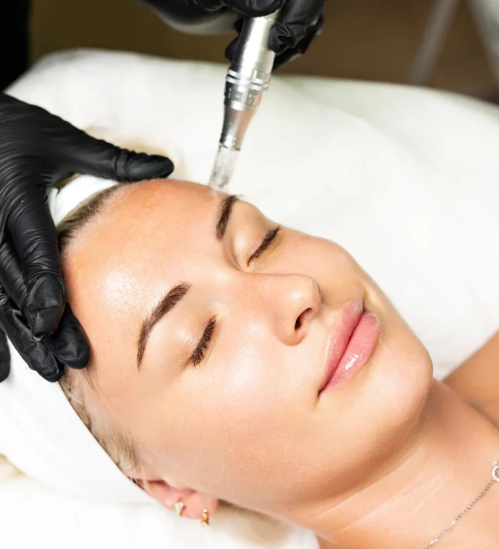 lifting-facial-por-dr-carlos-cervantes
